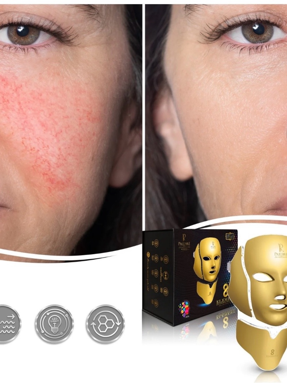 8 Element Multi-Purpose Skincare Mask | Non-Surgical Solution LED Treatment NIB! - Picture 5 of 10